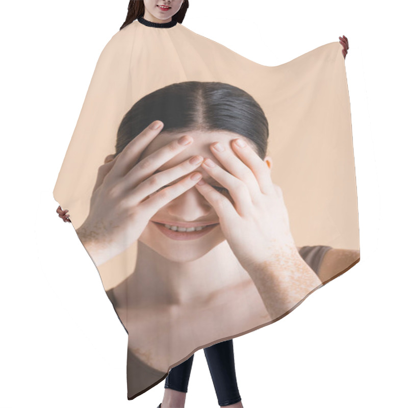 Personality  Smiling Young Beautiful Woman With Vitiligo Covering Eyes Isolated On Beige Hair Cutting Cape