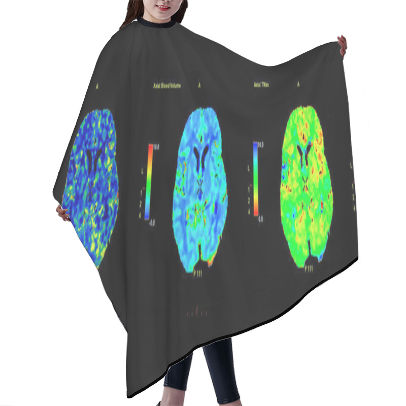 Personality  Perfusion CT Scan Of The Brain ,The Red And Green And Blue Are Areas Of Delayed Blood Flow To The Brain On The Perfusion CT Scan On The Screen. Hair Cutting Cape