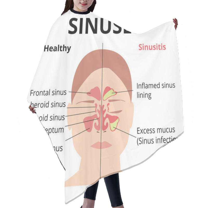 Personality  Sinusitis Medical Treatment. Nasal Sinus. Healthy And Inflammation Sinus. Nasal Diseases. Sinusitis, Sinus Infection Diagnosis  Medical Infographic Design. Otolaryngology Concept. Isolated On White Hair Cutting Cape