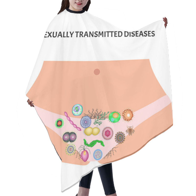 Personality  Viral And Bacterial Infections. Sexually Transmitted Diseases. Infographics. Vector Illustration On Isolated Background. Hair Cutting Cape