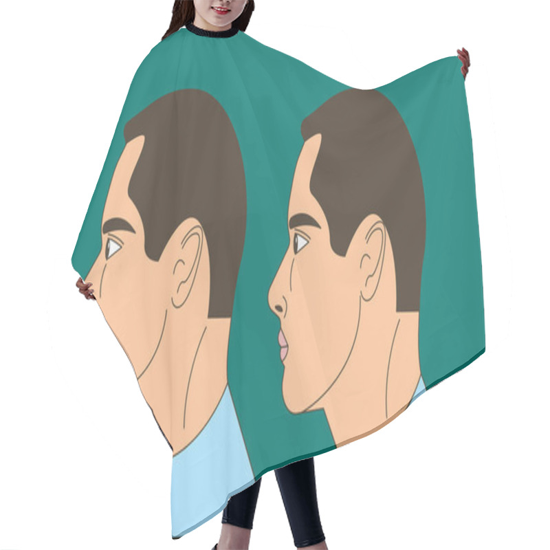 Personality  Distal Bite, Man With Malocclusion, Lower Jaw Pushing Back, Bite Correction By Braces. Vector Illustration Hair Cutting Cape