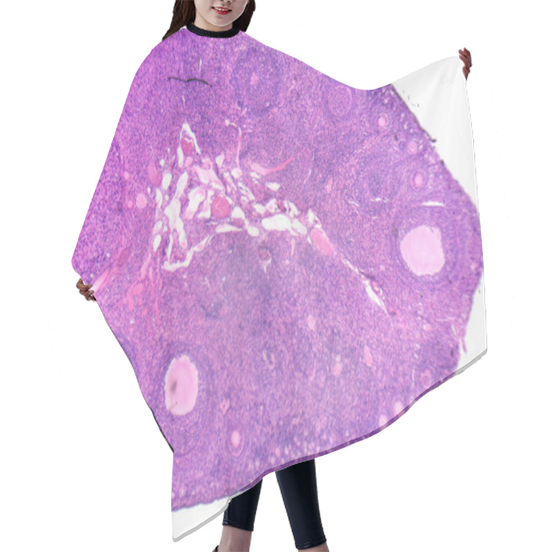 Personality  Micrograph Of Ovary Showing Primordial, Primary And Secondary Follicles Isolated On White Background. Hair Cutting Cape