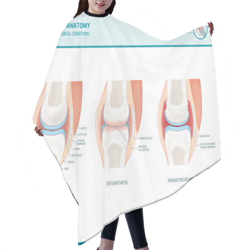 Personality  Joint Anatomy, Osteoarthritis And Rheumatoid Arthritis  Hair Cutting Cape