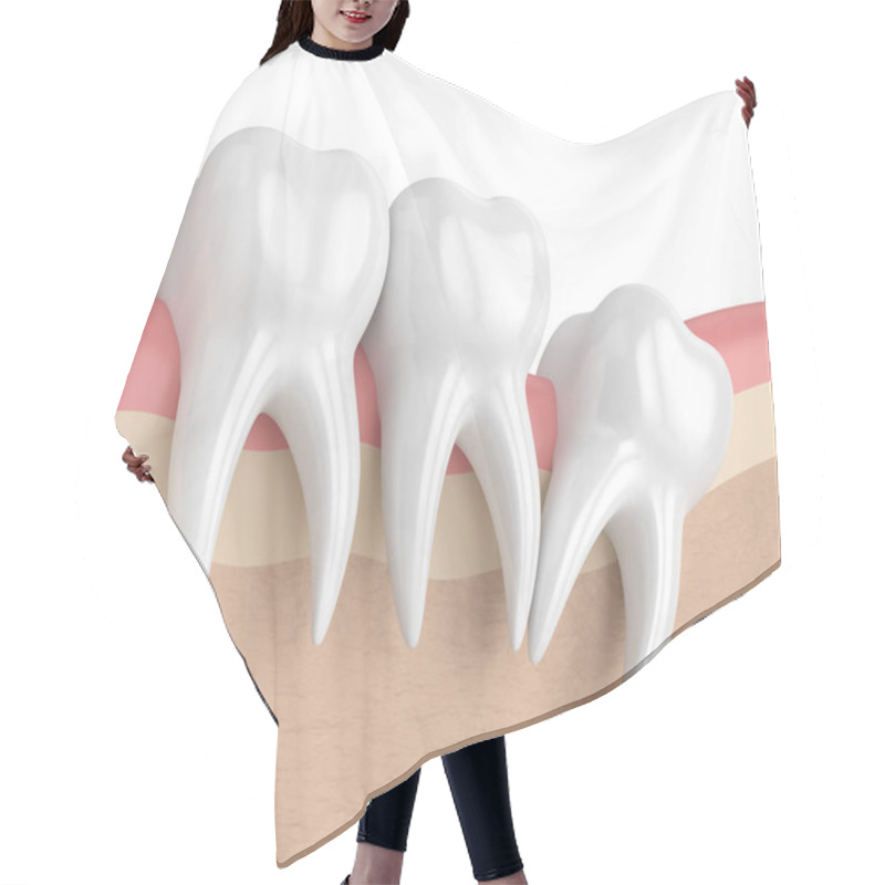 Personality  3d Render Of Teeth With Wisdom Distal Impaction Hair Cutting Cape