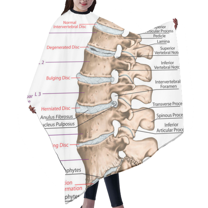 Personality  Spine Disc Problems, Degenerative Lumbar Disc Disease, Degenerative Disc Disorder, Degenerated Disk, Bulging Disk, Herniated Disk, Thinning Disk, Disk Degeneration With Osteophyte Formation Hair Cutting Cape