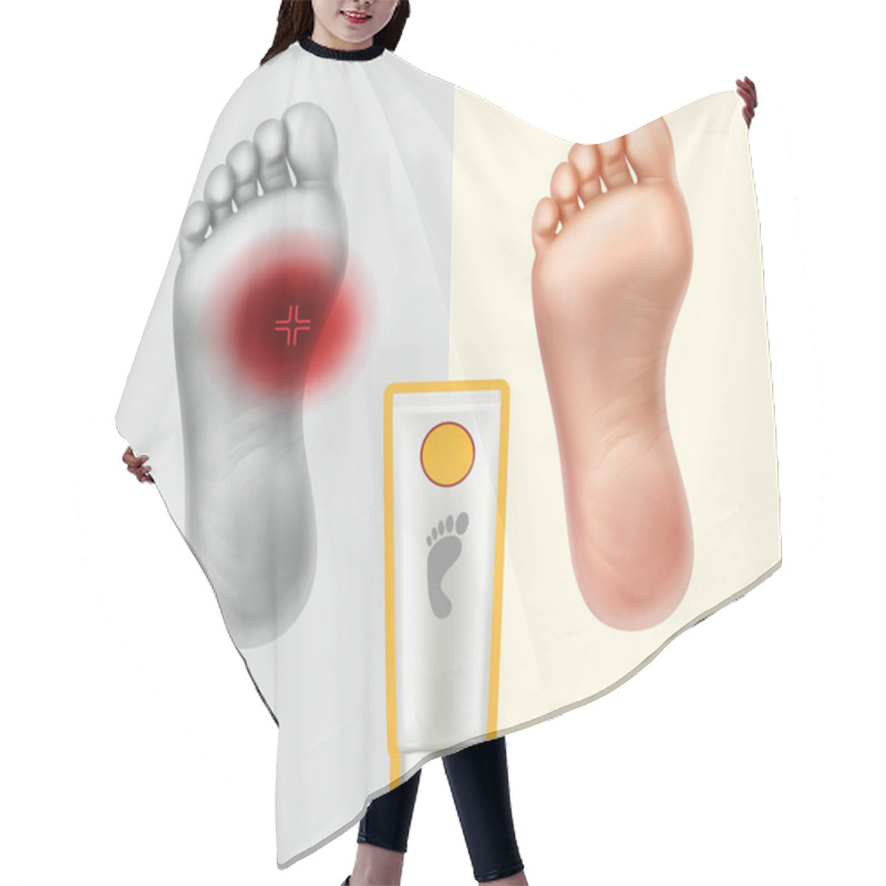 Personality  Vector Illustration Of Soles With Painful Point And Healthy. Cream For Skin Care And Neutralization Of Pain Hair Cutting Cape