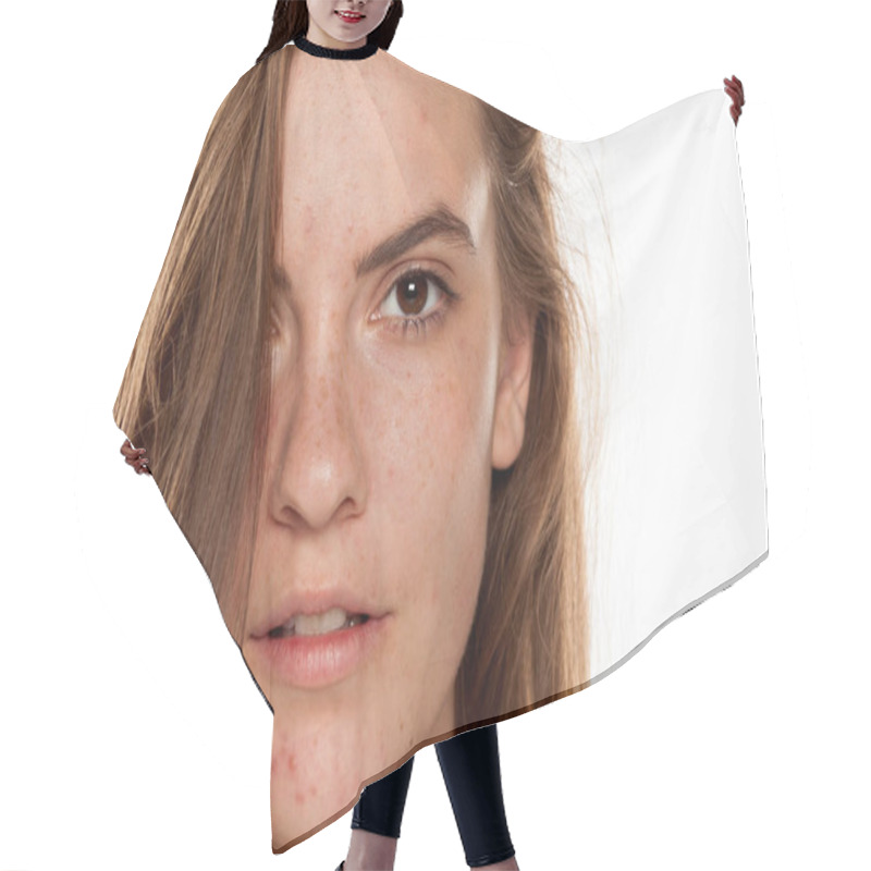 Personality  Portrait Of Young Beautiful Woman With Frackles And Problematic Skin On White Backgeound Hair Cutting Cape