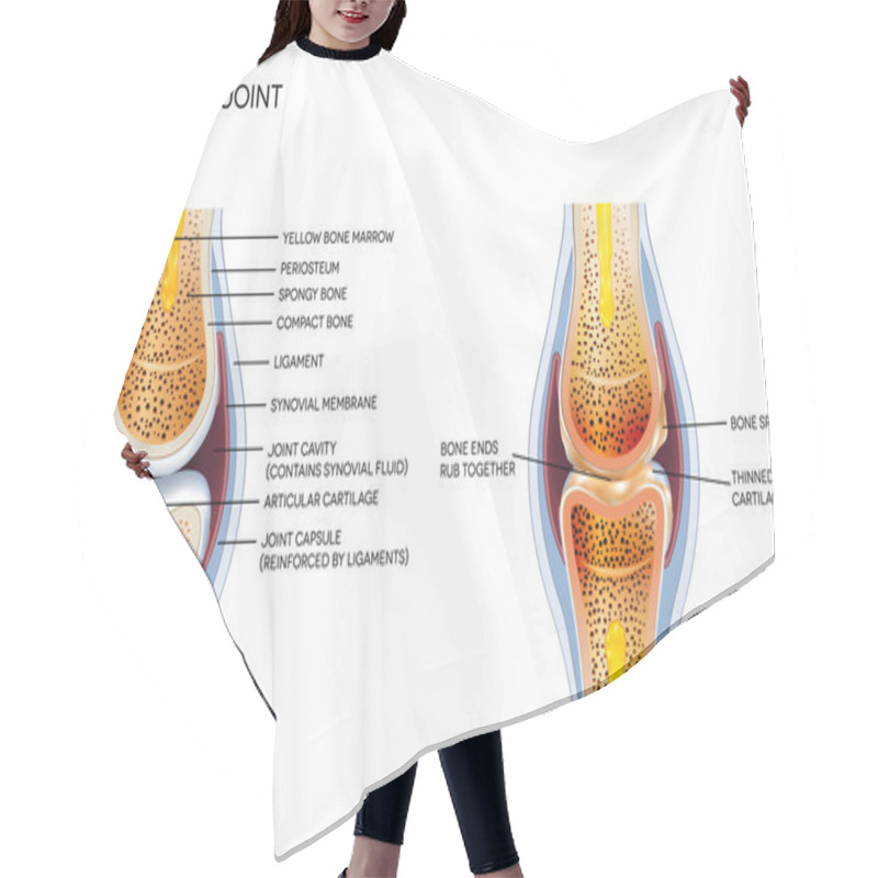 Personality  Osteoarthritis And Normal Joint Anatomy Hair Cutting Cape