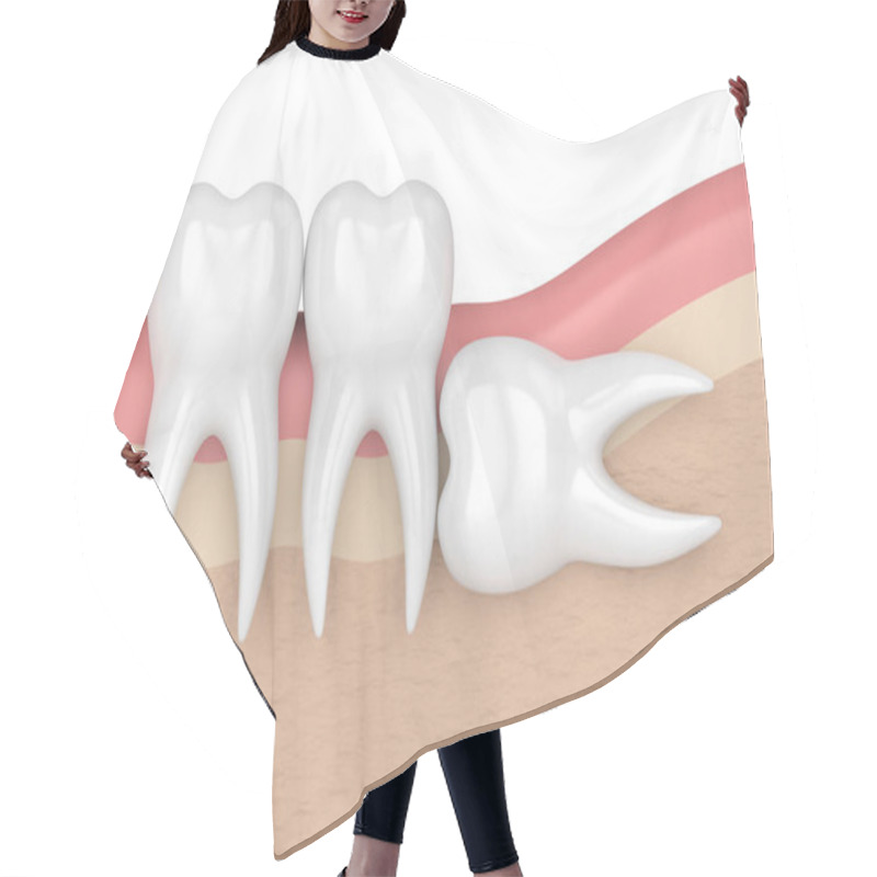 Personality  3d Render Of Teeth With Wisdom Horizontal Impaction Hair Cutting Cape