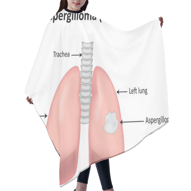 Personality  Aspergilloma Fungal Ball Infection In The Lungs Hair Cutting Cape