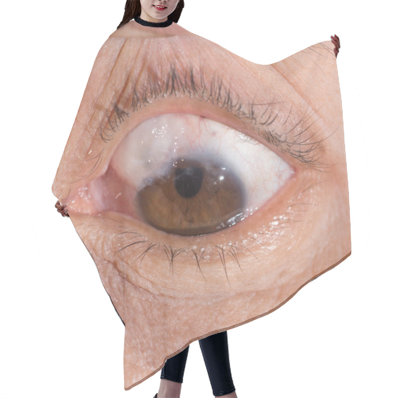 Personality  Trabeculectomy Bleb Eye Test Hair Cutting Cape