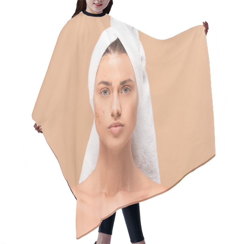 Personality  Nude Girl In Towel With Acne On Face Isolated On Beige  Hair Cutting Cape