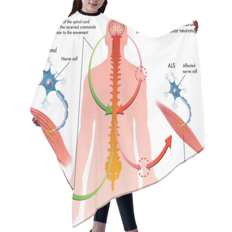 Personality  ALS (amyotrophic Lateral Sclerosis) Hair Cutting Cape