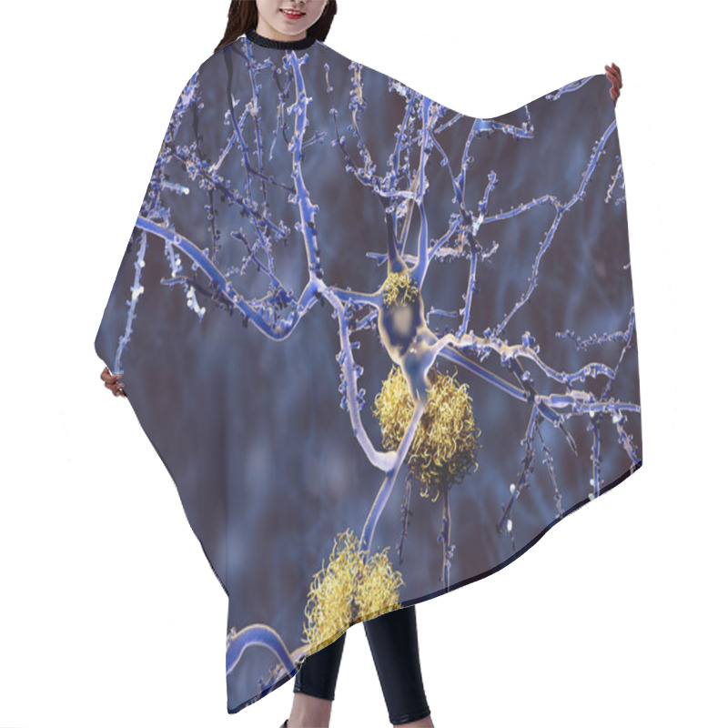 Personality  Alzheimer Disease: Neuron With Amyloid Plaques, Illustration Hair Cutting Cape