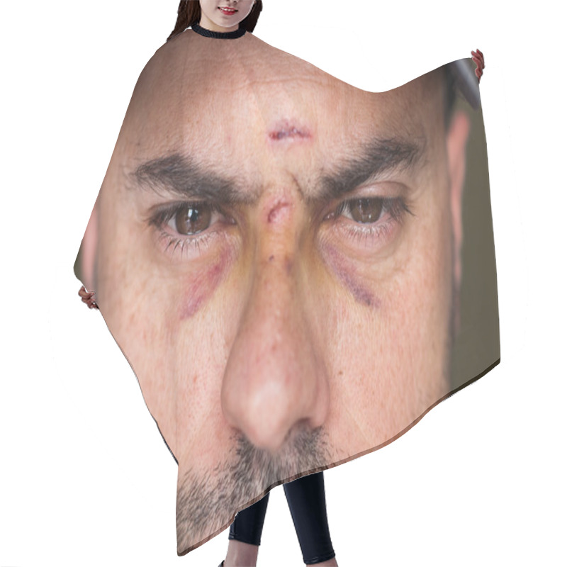 Personality  Black Eyes Of A Injured Man Hair Cutting Cape