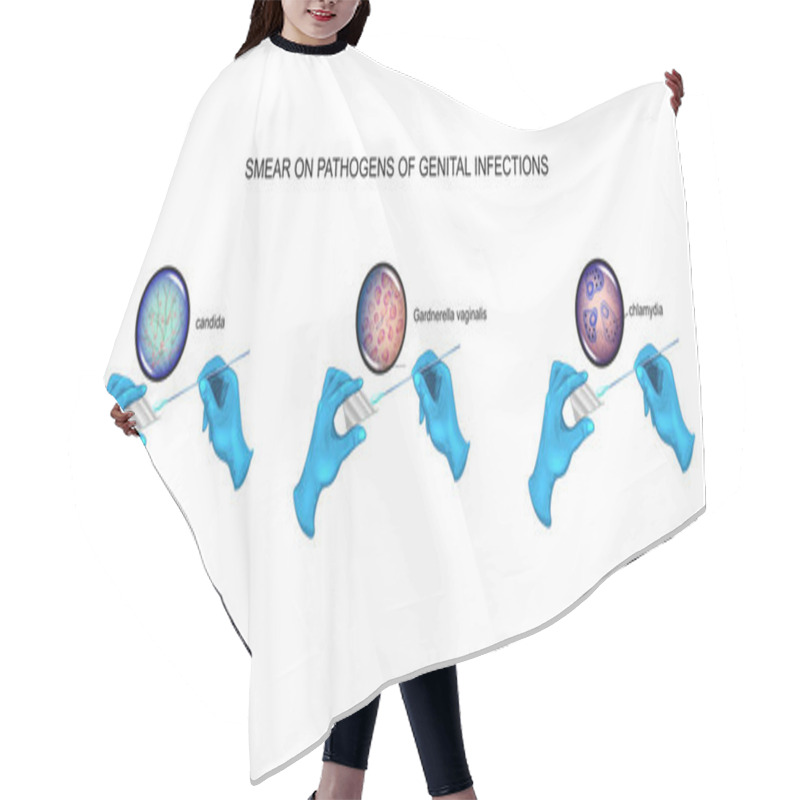 Personality  Vector Illustration Of Urological Smear. Candidiasis, Vaginosis, Chlamydia Hair Cutting Cape