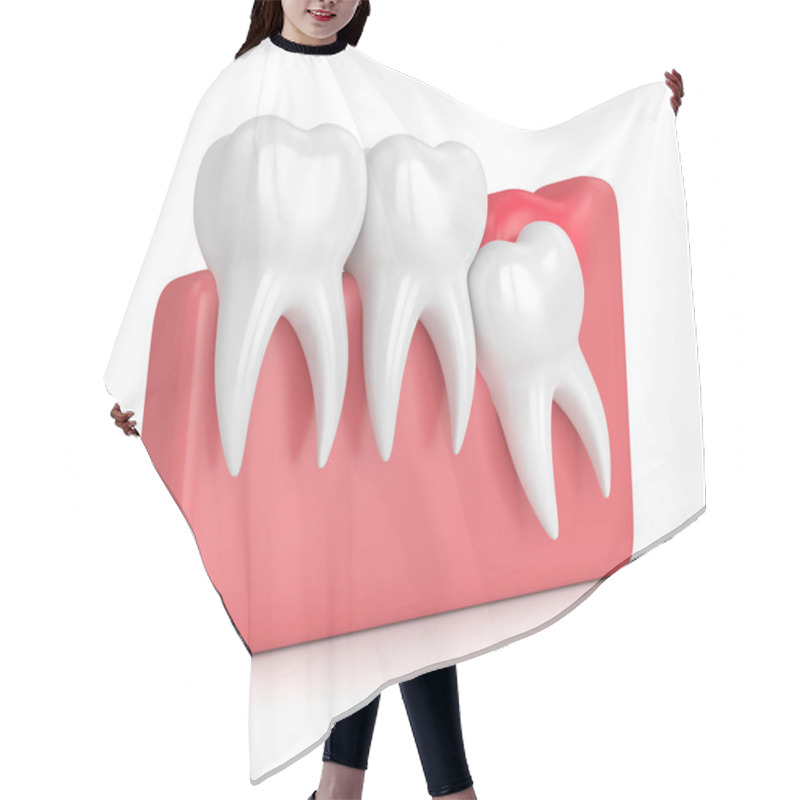 Personality  3d Render Of  Wisdom Mesial Impaction With Pericoronitis Hair Cutting Cape