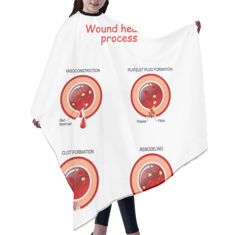 Personality  Phases Of The Wound Healing Process. Poster With Capillary, Red  Hair Cutting Cape