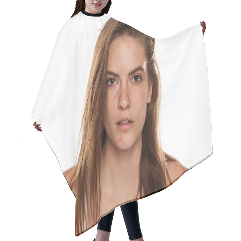 Personality  Portrait Of Young Beautiful Woman With Frackles And Problematic Skin On White Backgeound Hair Cutting Cape