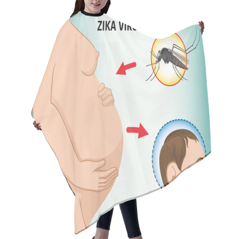 Personality  Illustration Of A Pregnant With Zika Virus And Newborn Baby With Microcephaly Disease, Aedes. Ideal For Informational And Institutional Related Sanitation And Medicine Hair Cutting Cape