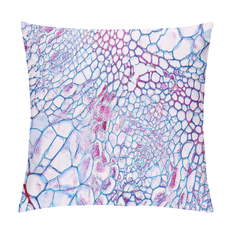 Personality  Zygomycota, Or Zygote Fungi ,Downy Mildew Of Cruzifers Host Tissue With Conidia Living In Decaying Plant On Slide Under The Microscope For Education. Pillow Covers