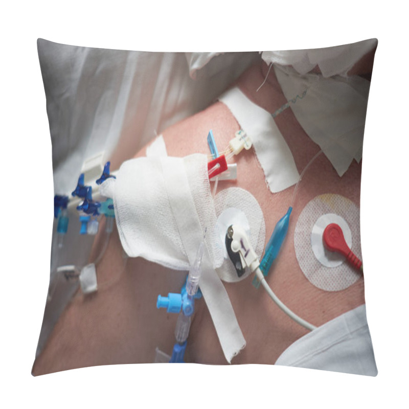 Personality  Central Venous Catheter Installed In Jugulares Vena Pillow Covers