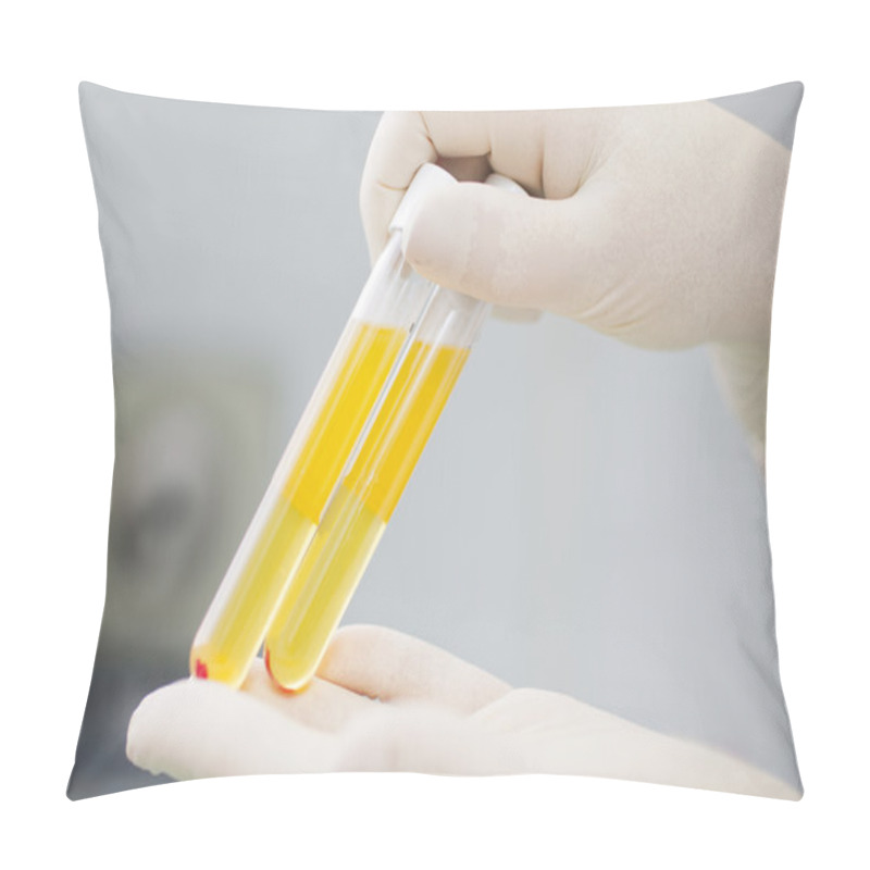 Personality  Blood Plasma In Test Tubes For Plasmalifting Pillow Covers