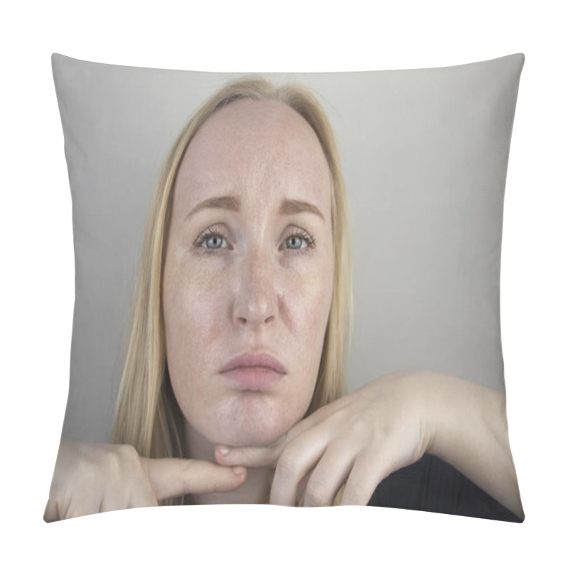 Personality  Oily And Problem Skin. Portrait Of A Blonde Girl With Acne, Oily Skin And Pigmentation Pillow Covers