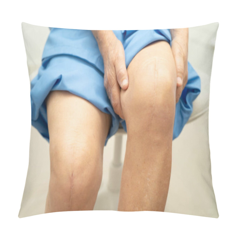 Personality  Asian Elderly Woman Patient With Scar Knee Replacement Surgery In Hospital. Pillow Covers