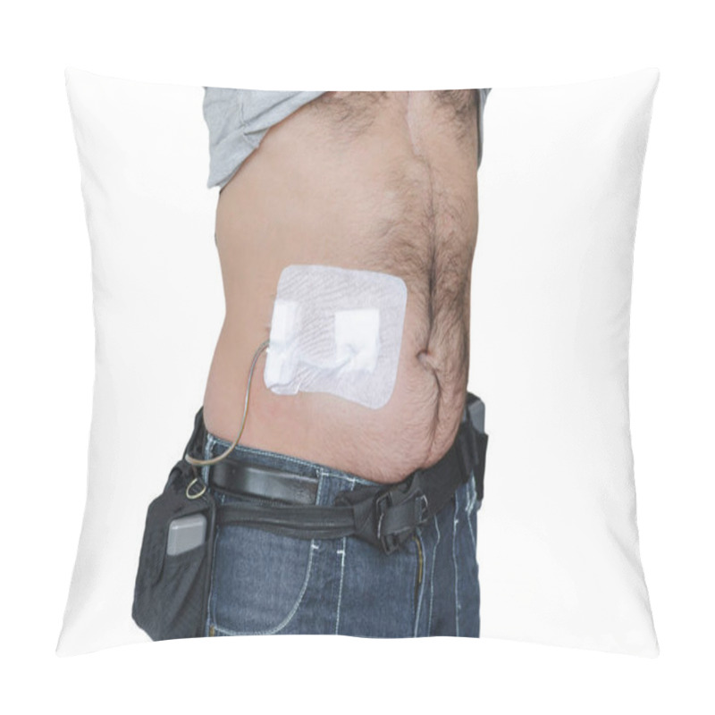 Personality  Man With An Assist Devices, Artificial Hearts, LVAD, Left Or Right Ventricular Assist Device, Controller Batteries And Power Supply Cable. Pillow Covers