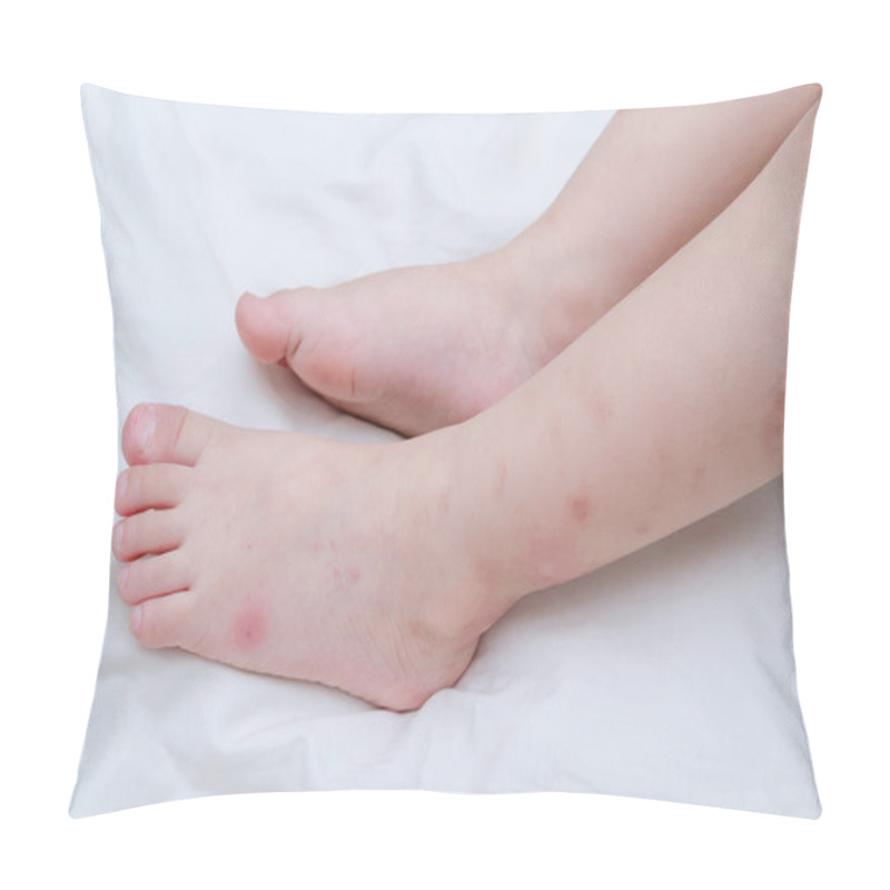 Personality  Mosquito Bites Sore Pillow Covers