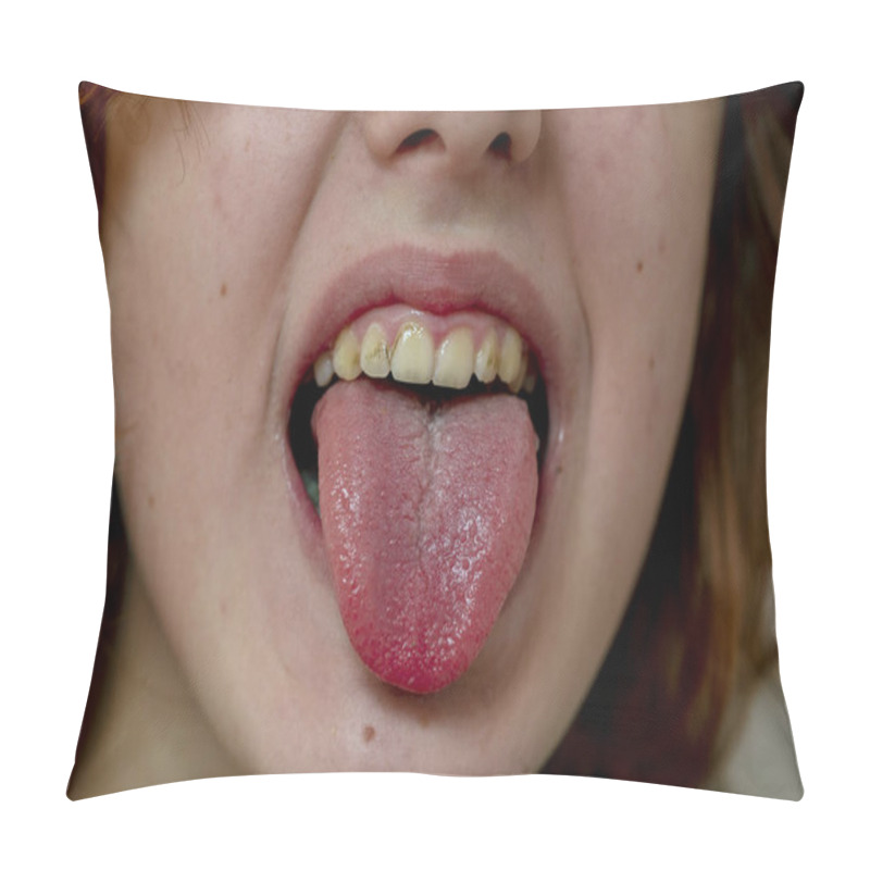 Personality  Teenage Girl Opens Her Mouth When Coughing, Sticking Out Her Tongue Pillow Covers