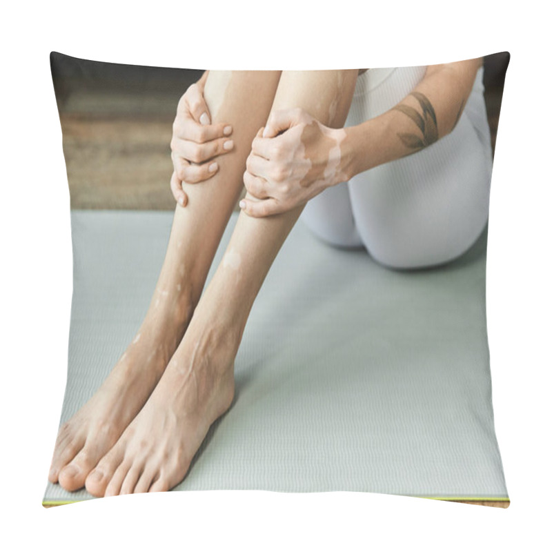 Personality  A young woman with vitiligo sits on a yoga mat in a modern apartment, her legs crossed and her hands resting on her shins. pillow covers