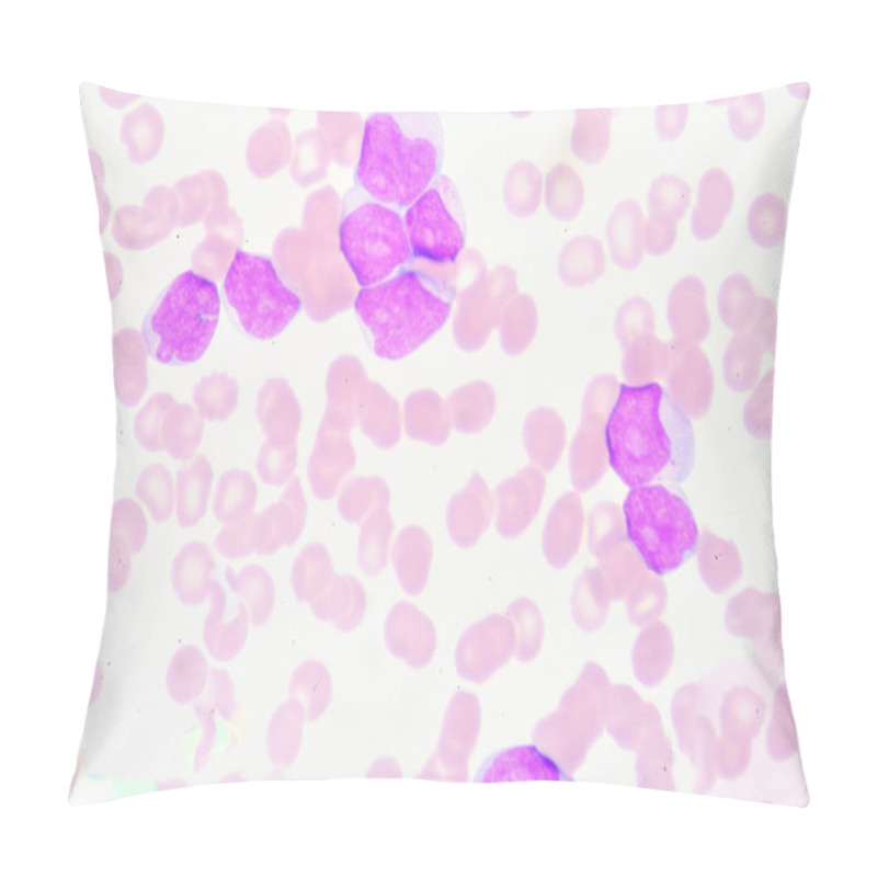 Personality  Lymphoblast Pillow Covers