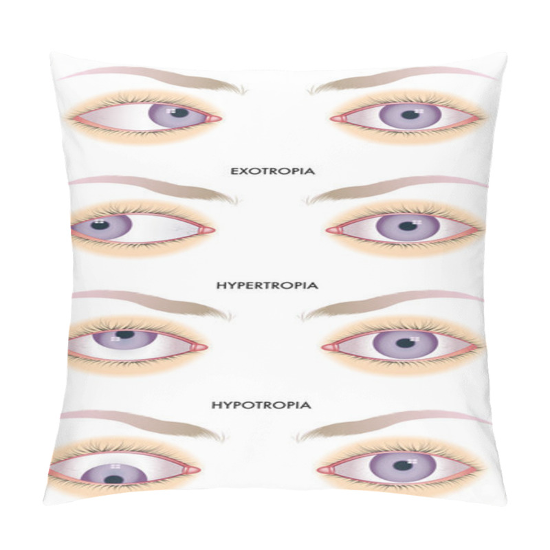 Personality  Strabismus Pillow Covers