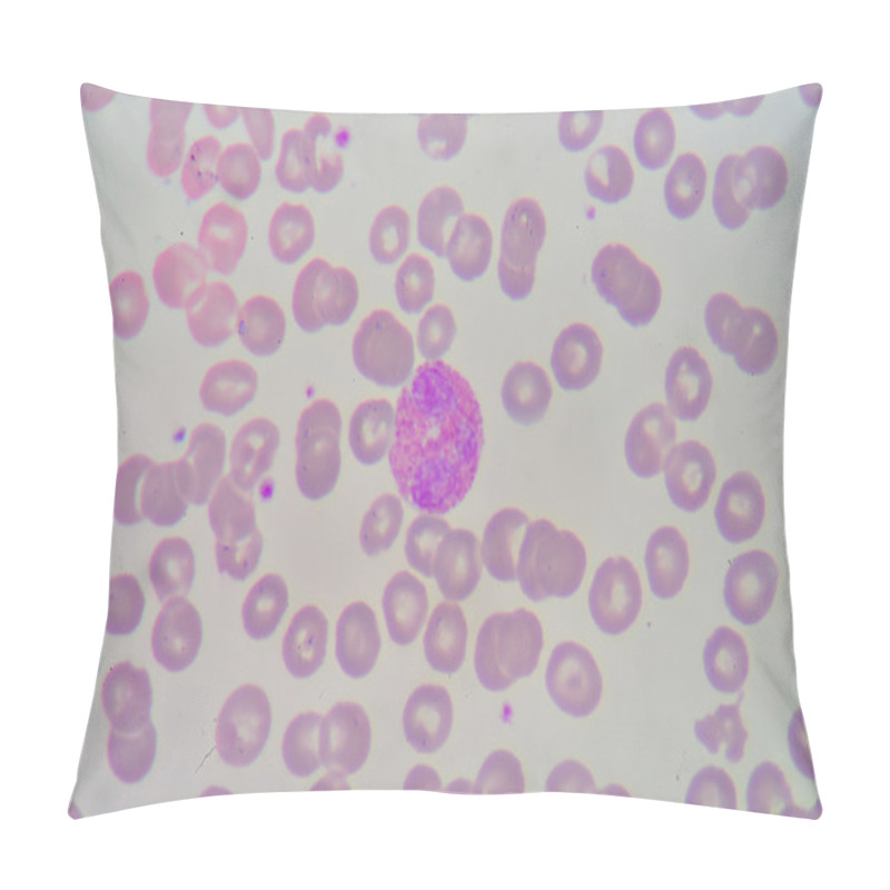 Personality  Eosinophil Pillow Covers