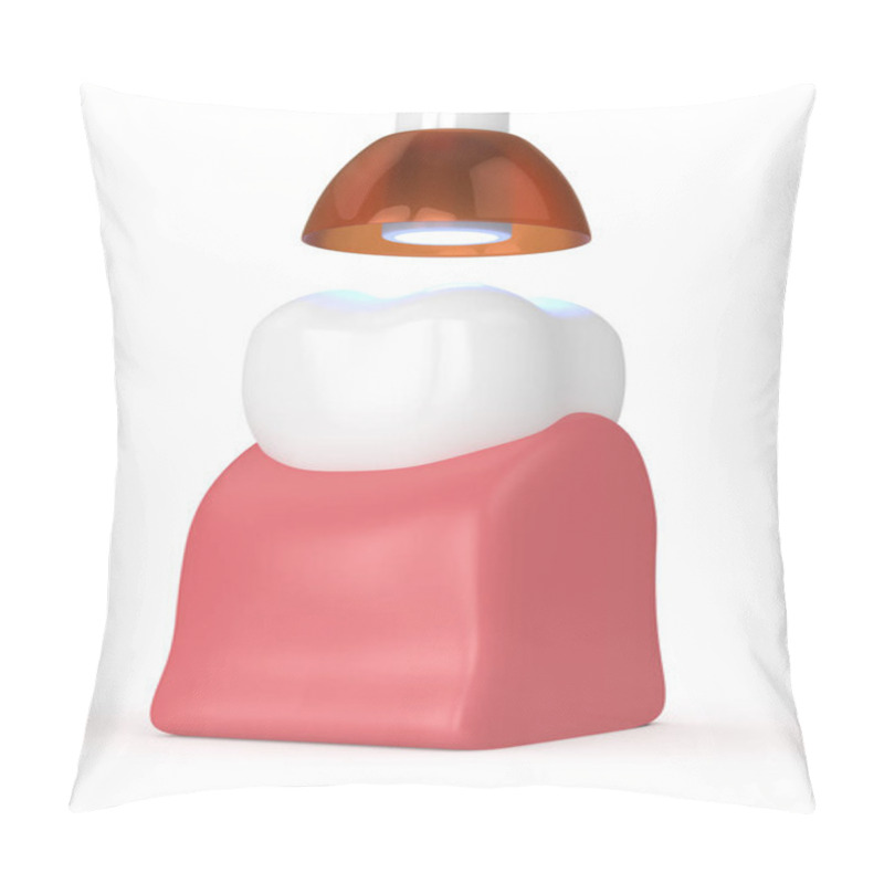 Personality  3d Render Of Tooth With Dental Polymerization Lamp And Light Cured Inlay Filling Over White Background Pillow Covers