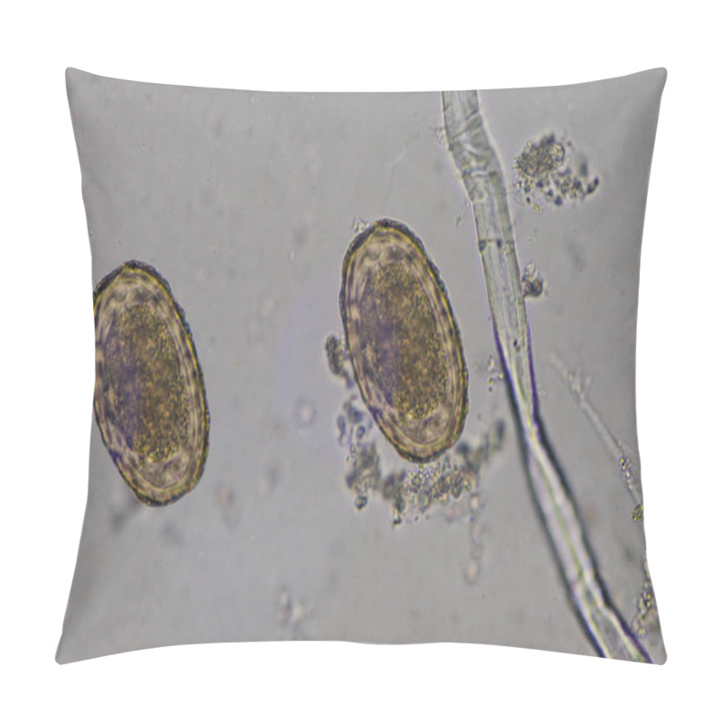 Personality  Parasite Egg Ascaris Lumbricoides Find With Microscope. Pillow Covers