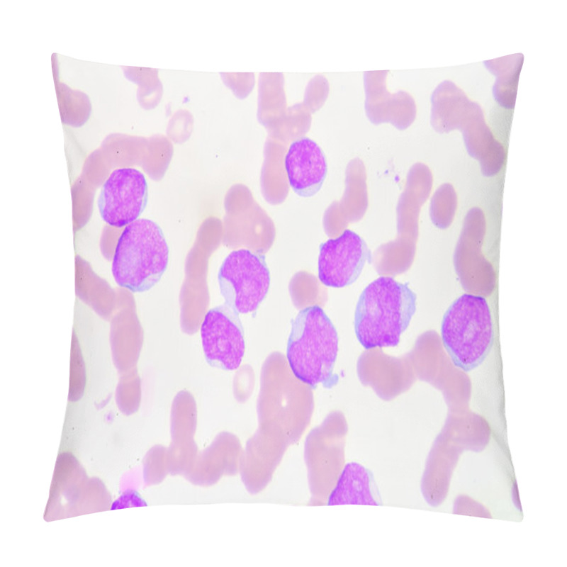 Personality  Lymphoblast Pillow Covers