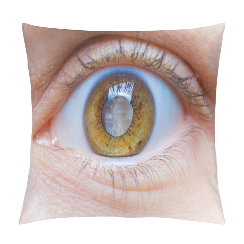 Personality  Human Eye With Clouded Lens, White Pupil, Cataract Macro Pillow Covers