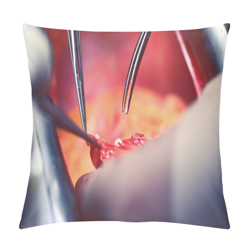 Personality  Operating Hands Of Doctors, Cardiac Surgery Pillow Covers