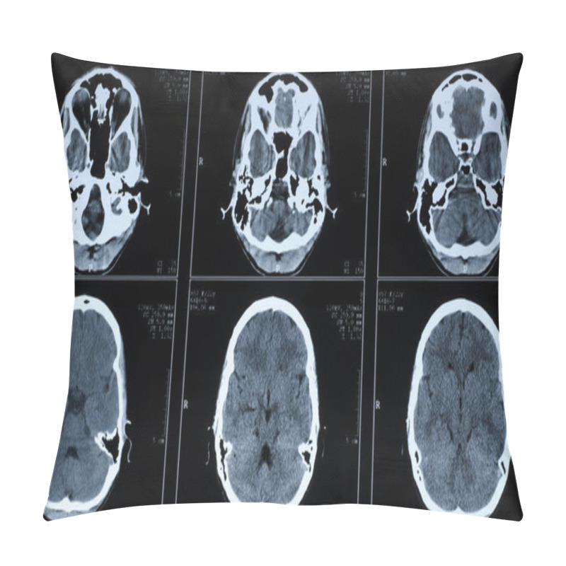 Personality  CT Photography Of Human Brain Pillow Covers