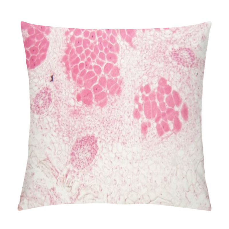 Personality  Root Bacteria Nodules Under The Microscope.  Pillow Covers