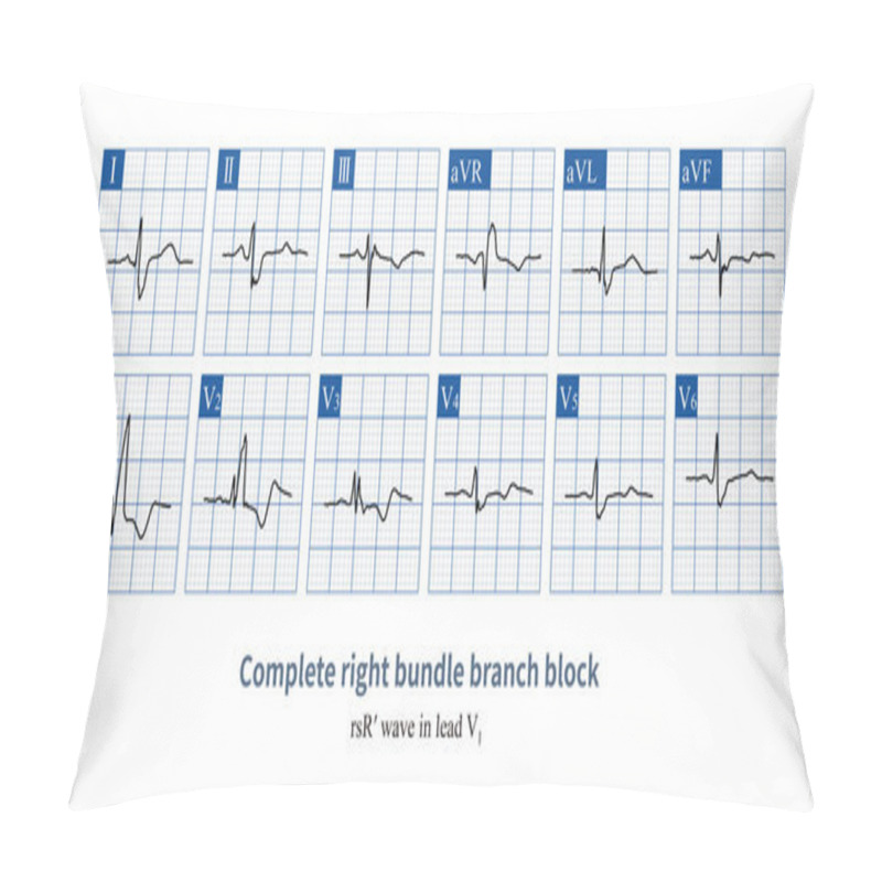 Personality  On A Conventional 12 Lead Electrocardiogram, The QRS Wave Of Complete Right Bundle Branch Block In Lead V1 Is Usually An RSR Three-phase Waveform. Pillow Covers