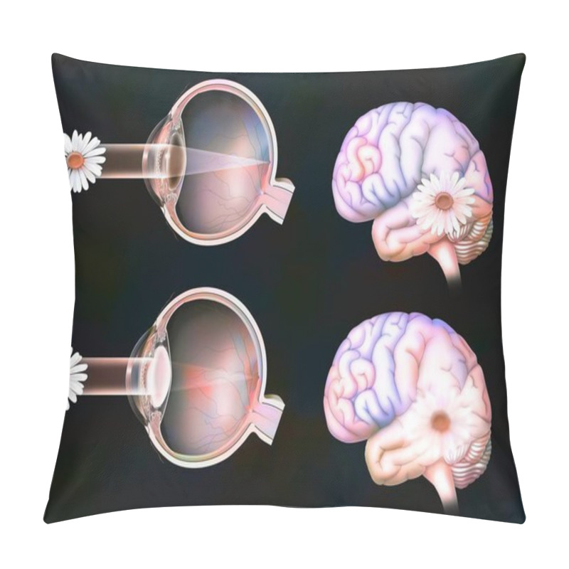 Personality  Comparison Between Normal Vision And That Of An Eye With Cataract. Pillow Covers