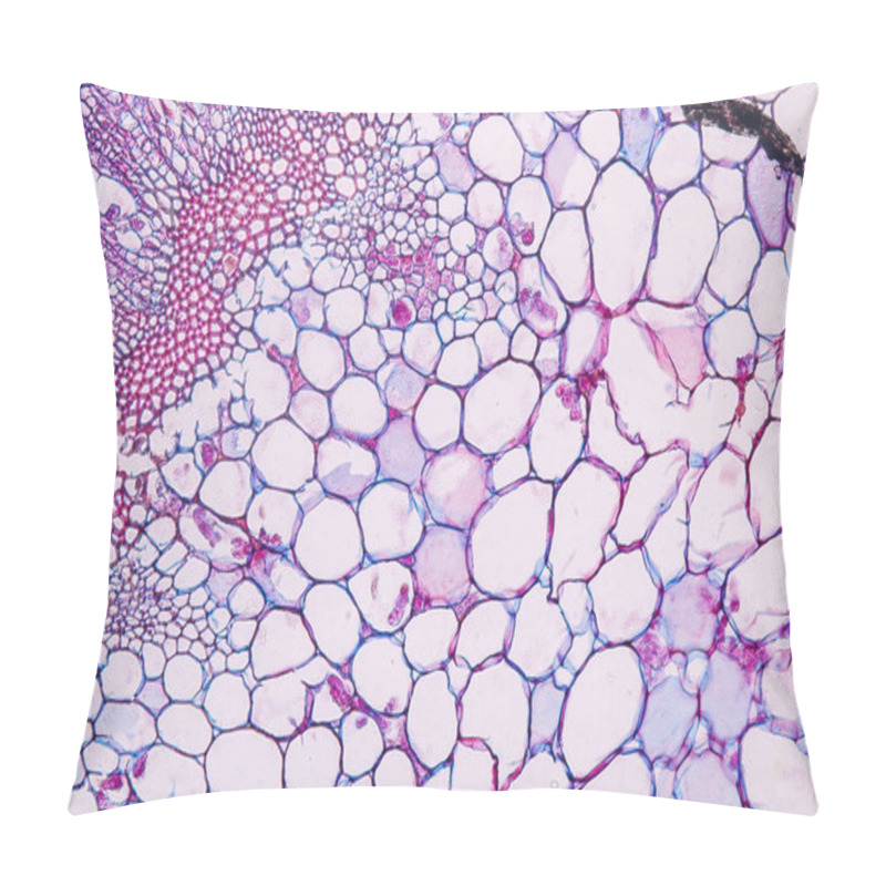 Personality  Zygomycota, Or Zygote Fungi ,Downy Mildew Of Cruzifers Host Tissue With Conidia Living In Decaying Plant On Slide Under The Microscope For Education. Pillow Covers