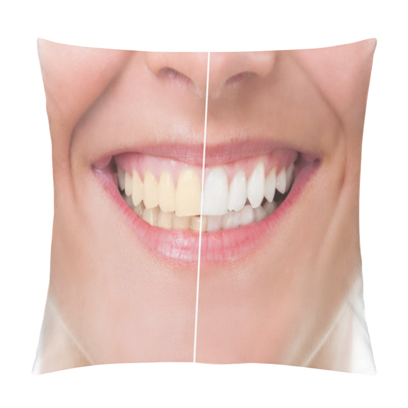 Personality  Before And After Whitening Pillow Covers