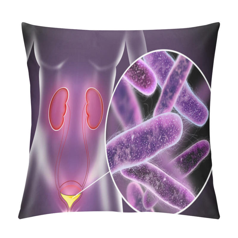 Personality  Illustration Of Woman Suffering From Cystitis. Urinary Infection Pillow Covers