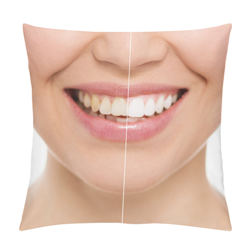 Personality  Dental Care Woman Pillow Covers