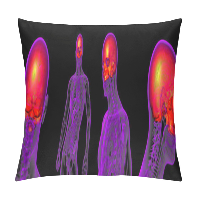 Personality  3d Rendering Medical Illustration Of The Upper Skull Pillow Covers